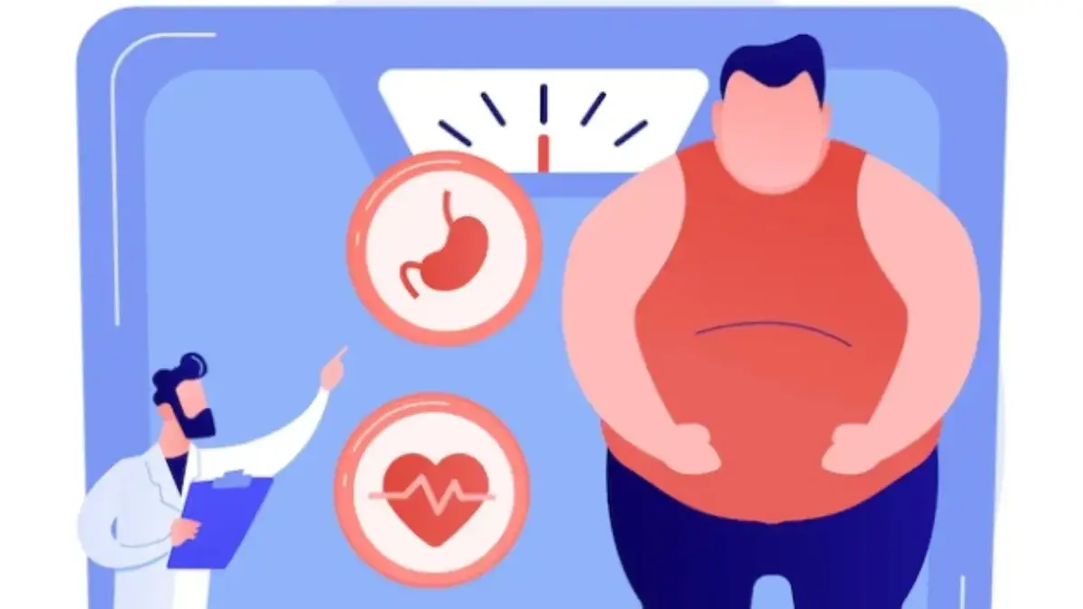 Bunda Harus Waspada, Anak Bisa Terkena Obesitas Gara-gara.. ilustrasi obesitas
