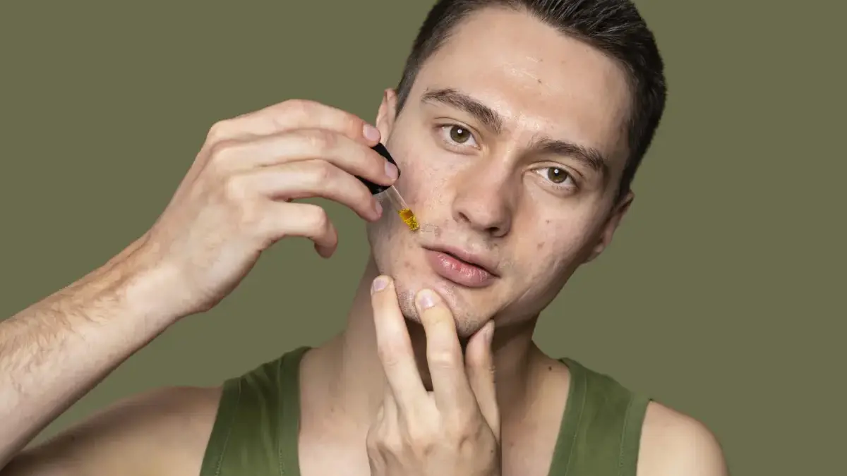 Rekomendasi Obat Totol Jerawat: Aman, Ampuh, dan Mudah Didapat! Rekomendasi Obat Totol Jerawat: Aman, Ampuh, dan Mudah Didapat!