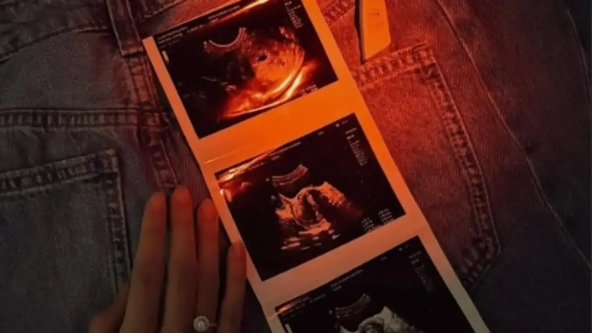Selebgram Anselma Umumkan Kehamilan Anak Pertama: “From Two Hearts to Three”