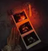 Selebgram Anselma Umumkan Kehamilan Anak Pertama: “From Two Hearts to Three”