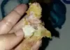 Tangkapan layar rekaman menu MBG berisi plester luka