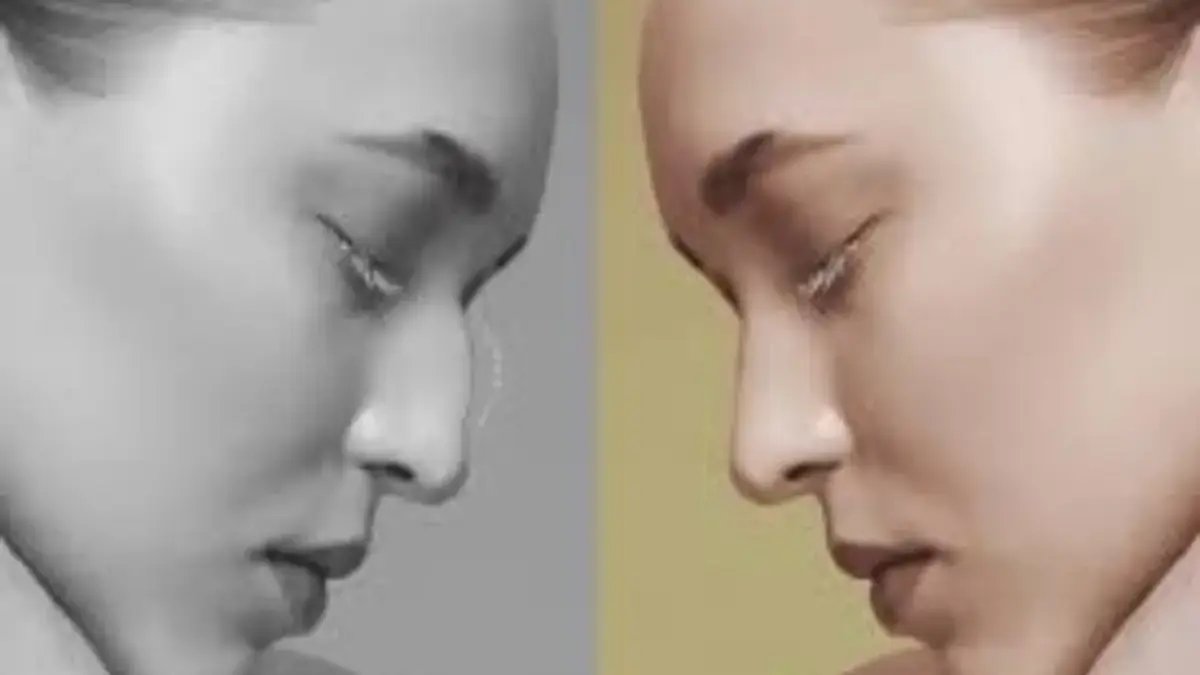 Hukum Tanam Benang di Hidung dalam Islam, Bolehkah Demi Kecantikan? Hukum Tanam Benang di Hidung dalam Islam, Bolehkah Demi Kecantikan?